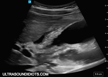 NARI PURELY SONIC NARL ULTRA SOUND クリアランス特価 inspektorat